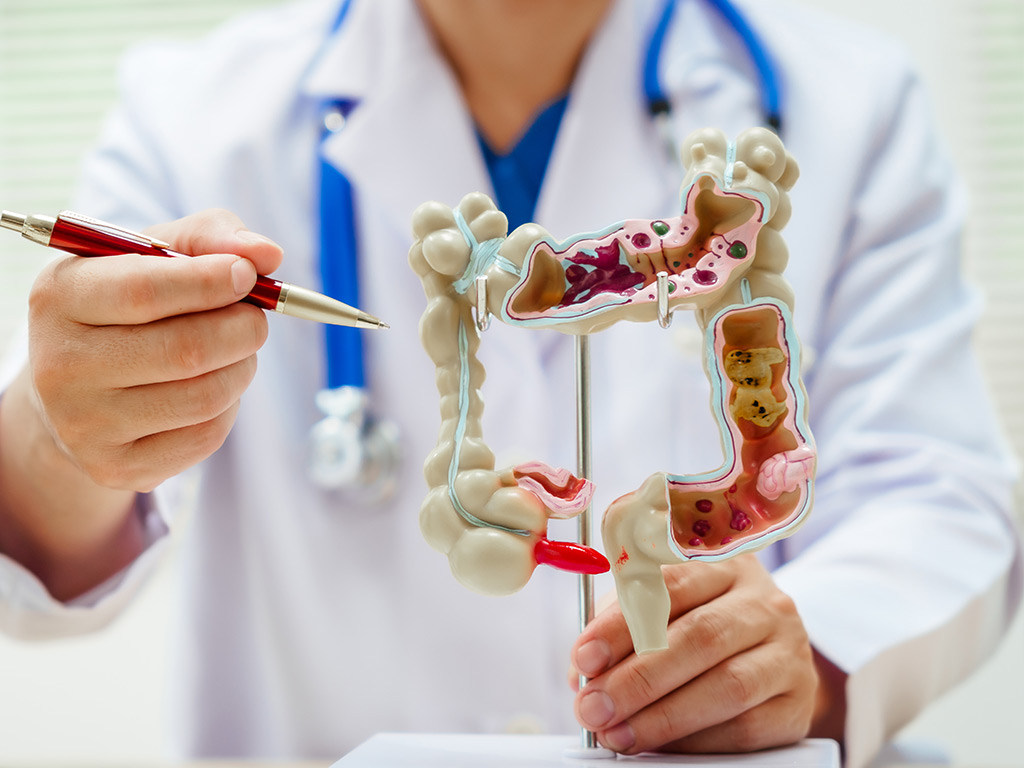 doctor points with pen to plastic colon model